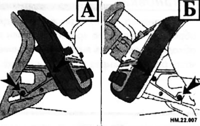 A - lijeva strana; B - desna strana.