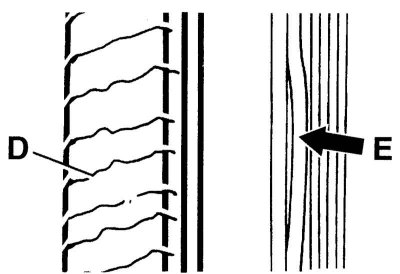Папярочныя расколіны (D) са зваротнага боку рамяня і адпластаванне рэбраў (E)